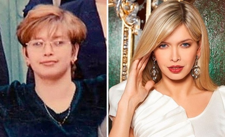 Российские звезды, которые сильно изменились за время своей карьеры (фото)