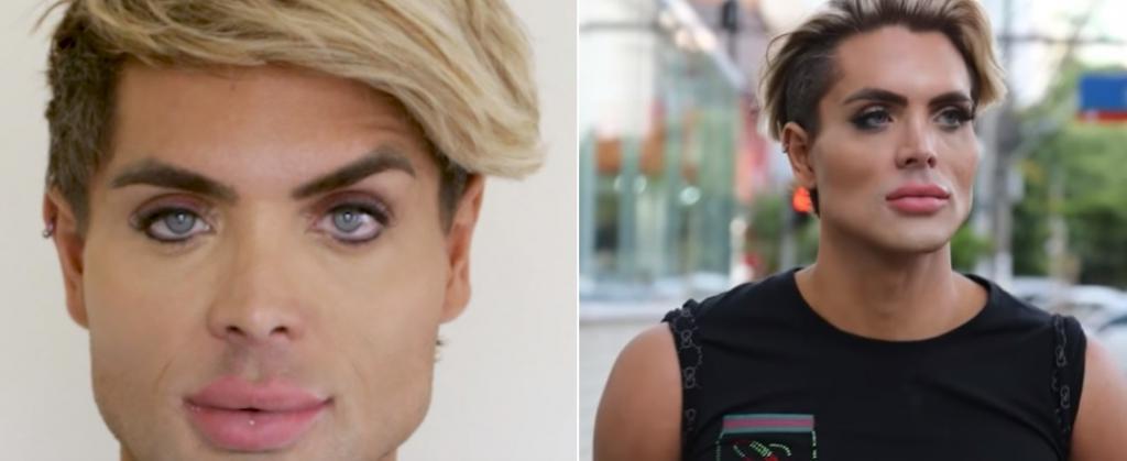 Бразилец, потративший $1 млн, чтобы стать "Кеном", показал, как выглядел до преображения (фото)