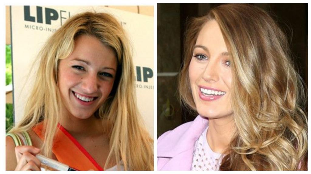 Тот случай, когда пластика пошла во благо: 10 знаменитых женщин, чья внешность поменялась только в лучшую сторону