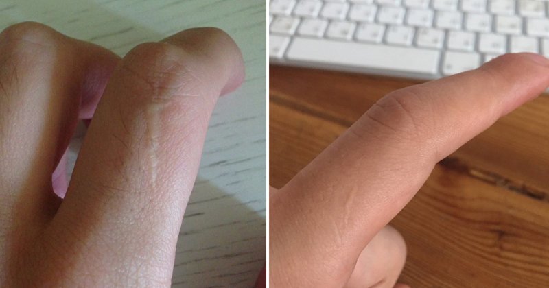Люди в Сети обнаружили, что почти у всех мужчин есть шрамы на указательных пальцах
