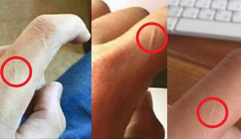 Люди в Сети обнаружили, что почти у всех мужчин есть шрамы на указательных пальцах