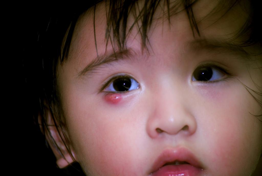 заболевания глаз у детей фото и названия