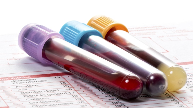 Биохимический анализ крови при беременности: как сдавать, расшифровка результатов