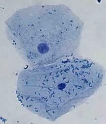 прокариотическая клетка