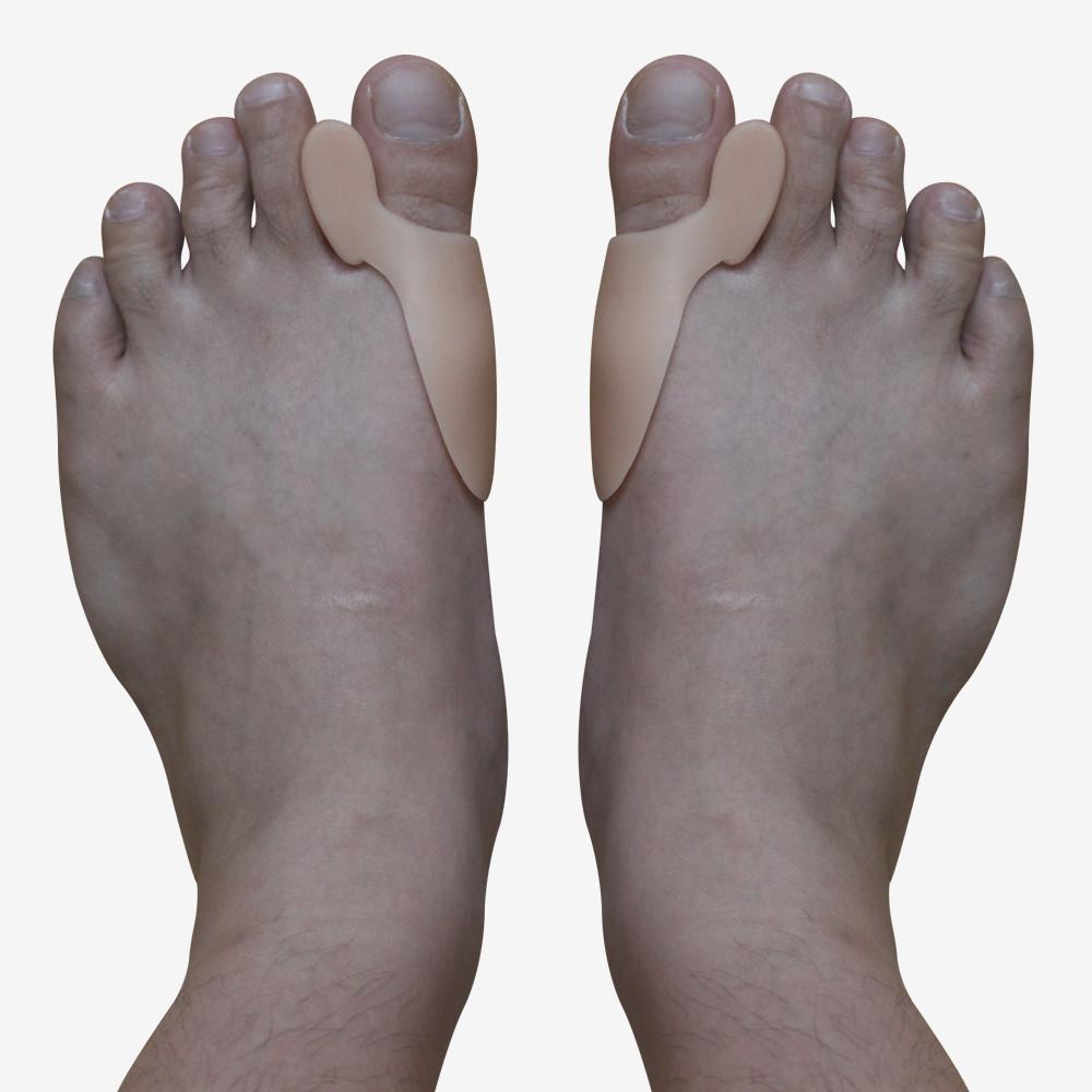 Артрит большого пальца ноги