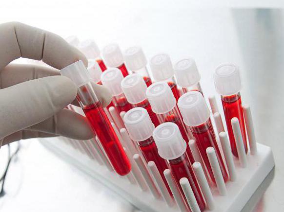 Расшифровка лейкоцитов в анализе крови