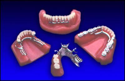 протезирование зубов отзывы