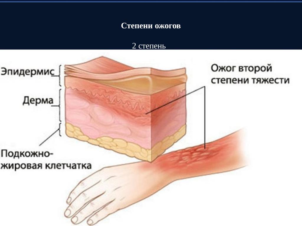 Схема кожного покрова