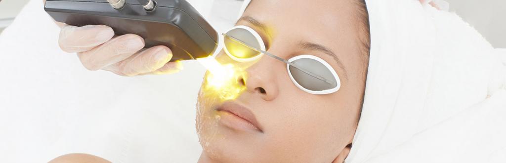 Лазерная процедура для лица: особенности процедуры, эффективность, фото