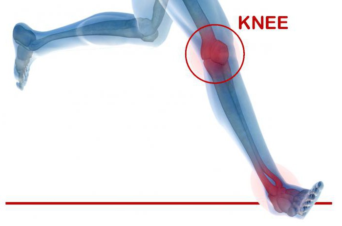 замена коленного сустава после операции