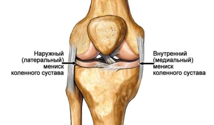повреждения мениска коленного сустава