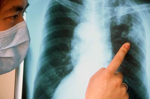 симптом туберкулеза легких