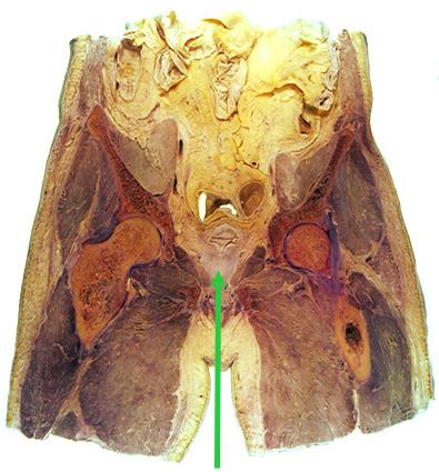 предстательная железа анатомия
