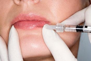 Увеличение губ гиалуроновой кислотой отзыв