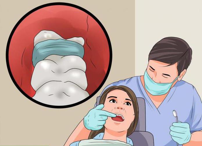 альвеолит после удаления зуба лечение дома