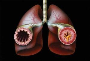 спирография при бронхиальной астме