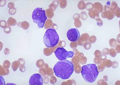 что такое лейкоциты в крови