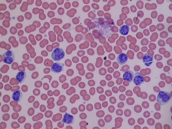 лимфоциты в крови у ребенка