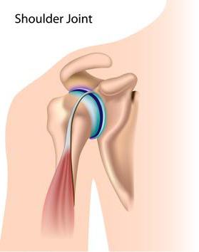 периартрит плечевого сустава лечение отзывы