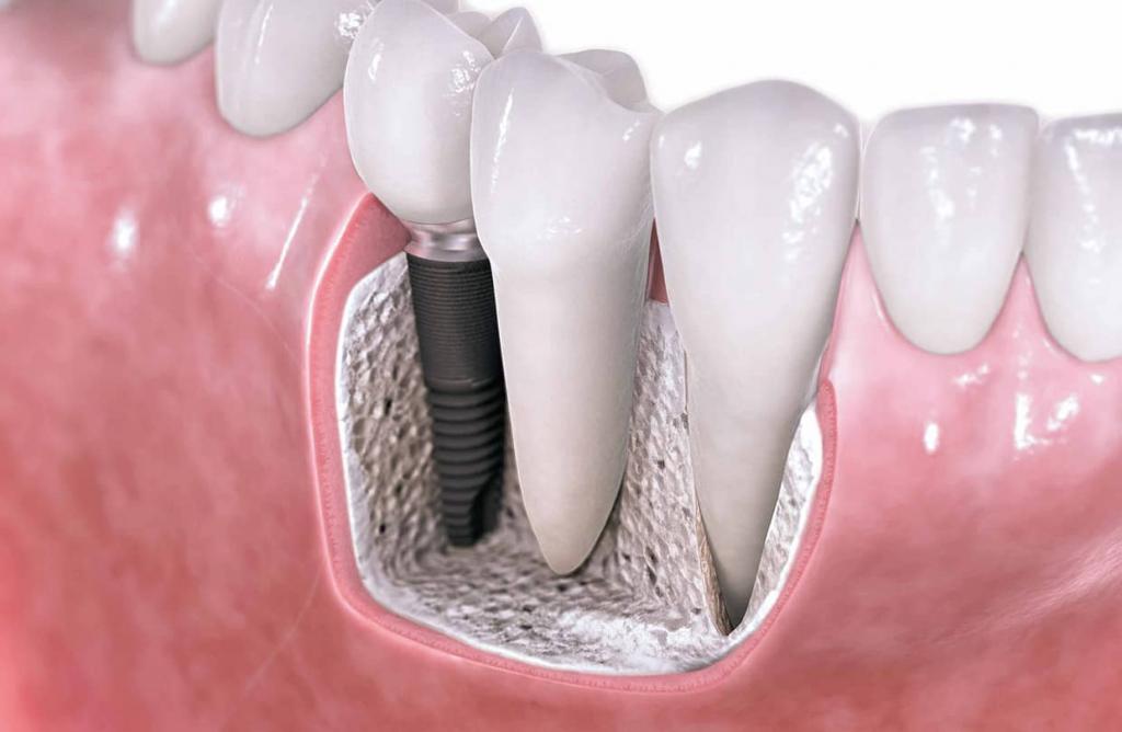 развитие зуба гистология