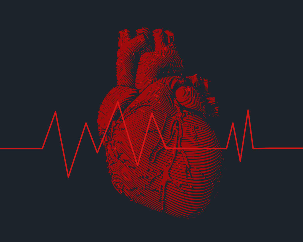 как вылечить аритмию сердца