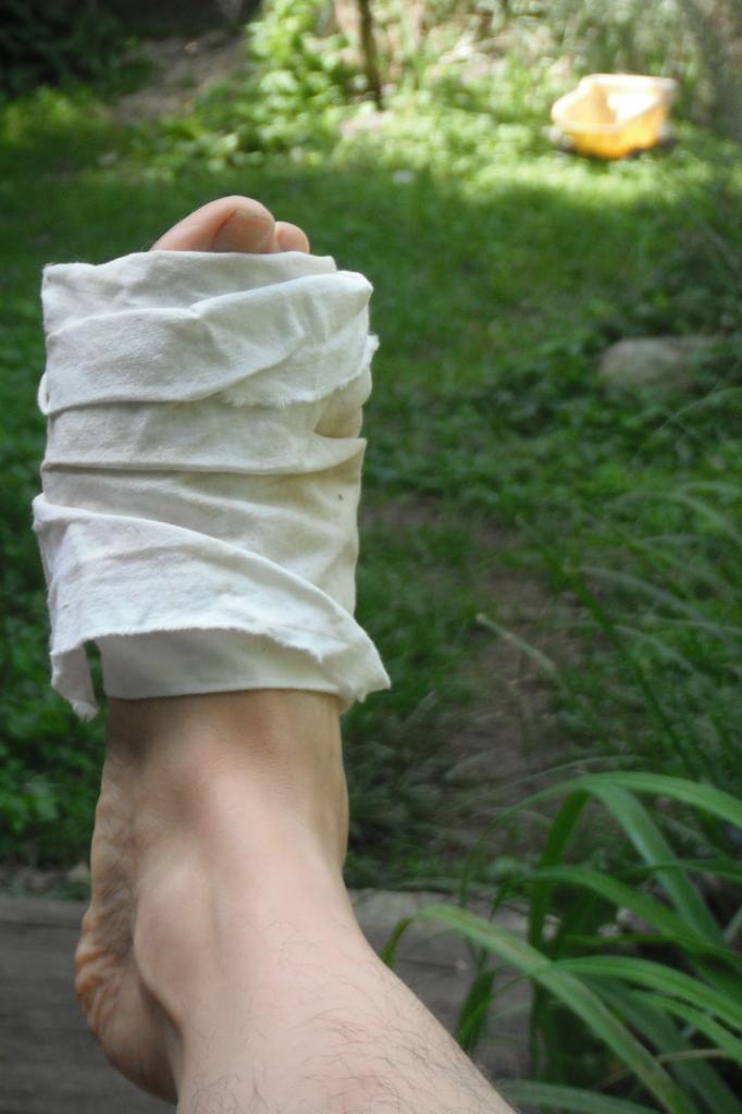 народное лечение подагры на большом пальце ноги