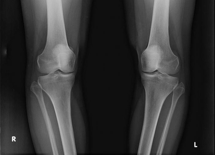 что показывает рентген ноги