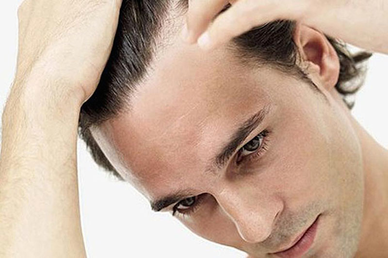 Уход за мужскими волосами. Мужская косметика для волос
