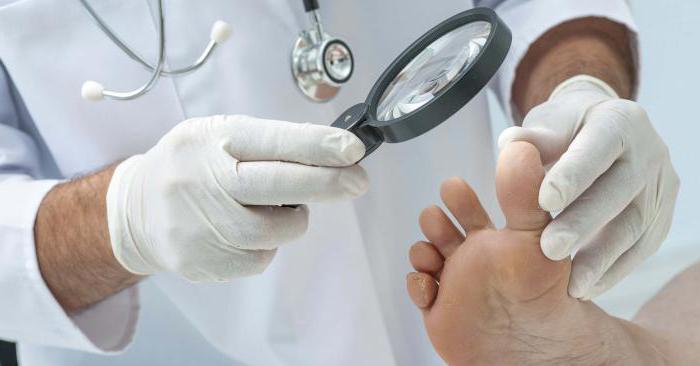 какой врач лечит грибок ногтей на ногах правильное лечение