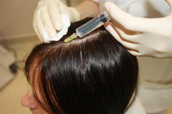 мезотерапия волос какой препарат