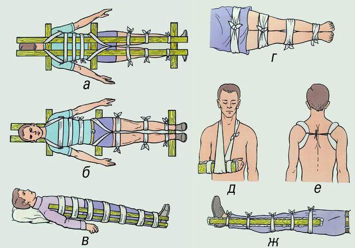 вывихи переломы конечностей первая помощь