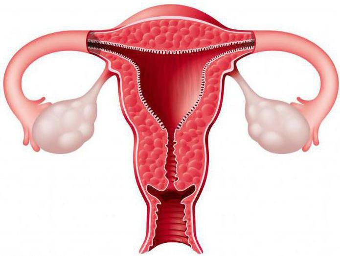гипоплазия матки что это такое