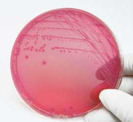 escherichia coli в мазке