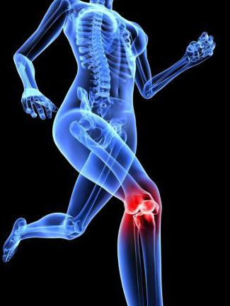 деформированный артроз коленного сустава