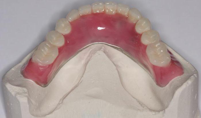 нейлоновый протез при полном отсутствии зубов