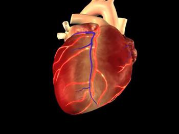 Инфаркт передней стенки сердца