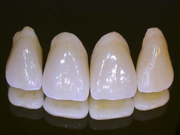 коронка фарфоровая на зуб