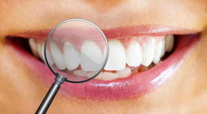 профессиональная чистка зубов акция спб 
