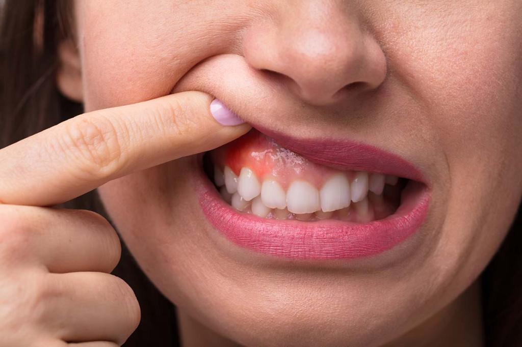 Зуб отошел от десны: как оказать себе первую помощь и что делать дальше