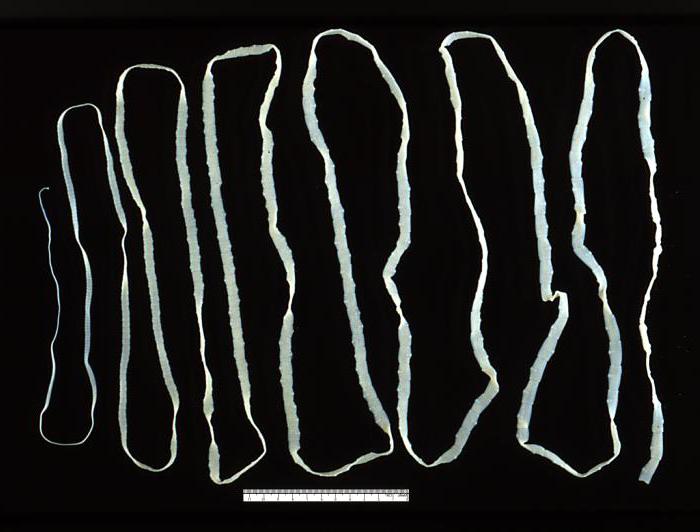 большие черви в организме человека