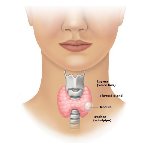 щитовидная железа, заболевания, симптомы, лечение щитовидной железы