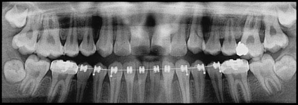 зубы ортодонт
