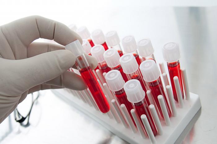 анализ крови билирубин общий норма