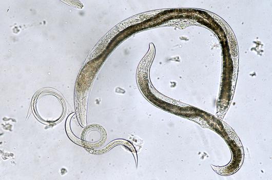 круглые черви паразиты человека