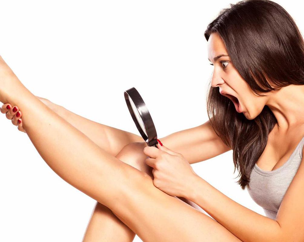 Чешутся ноги после бритья: что делать? Способы эпиляции