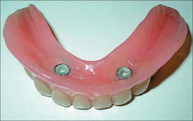 льготное протезирование зубов ветеранам труда