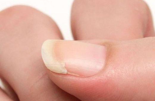 Почему отходит гель от ногтей: причины. Хороший гель-лак. Технология нанесения гель-лака