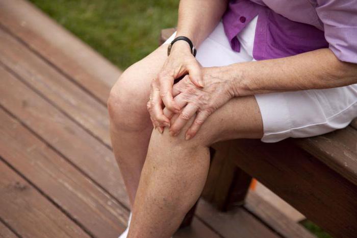  симптомы остеоартроза коленного сустава