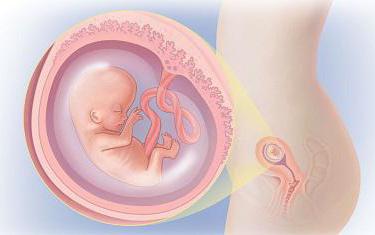 аборт на 10 неделе 