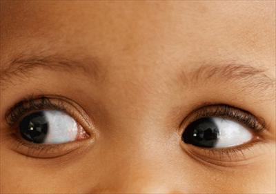 характеристика детей с нарушением зрения